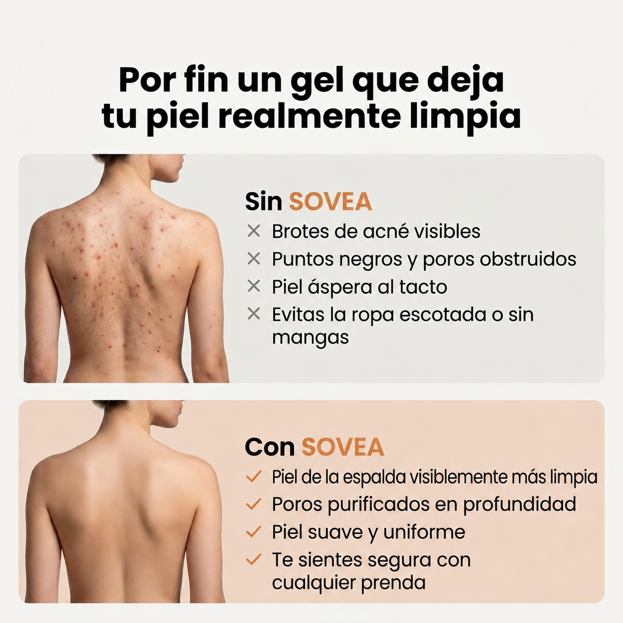 Gel De Baño Anti Acné SOVEA™