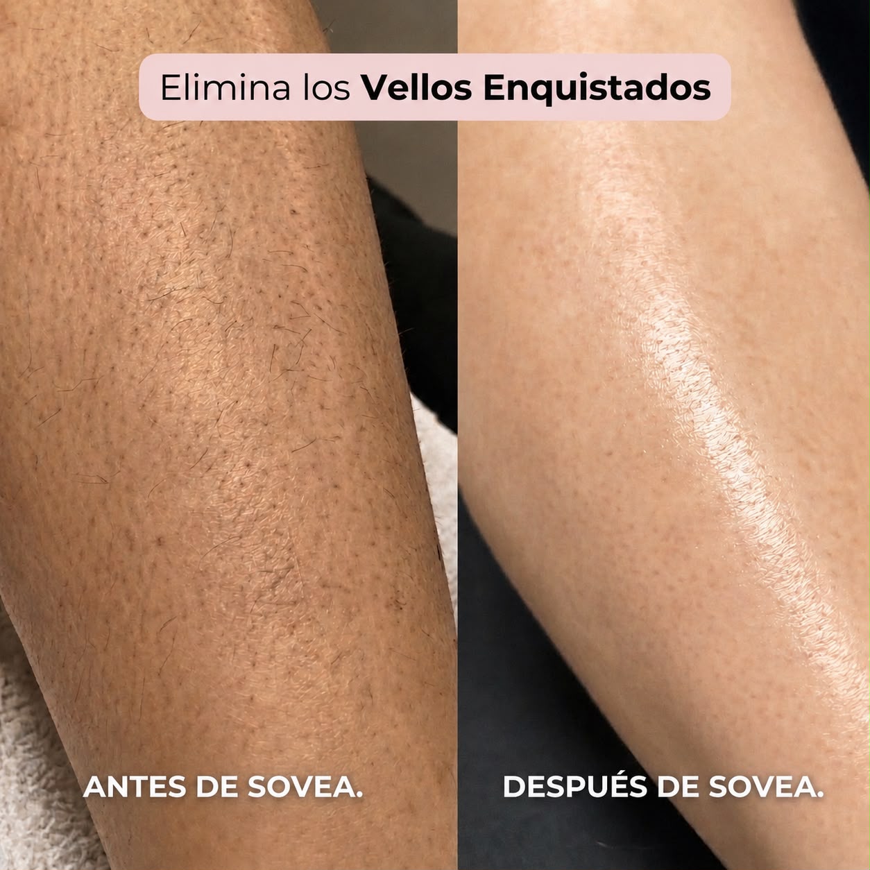 DEPILADORA 2 EN 1 PARA BIKINI Y CUERPO SOVEA™