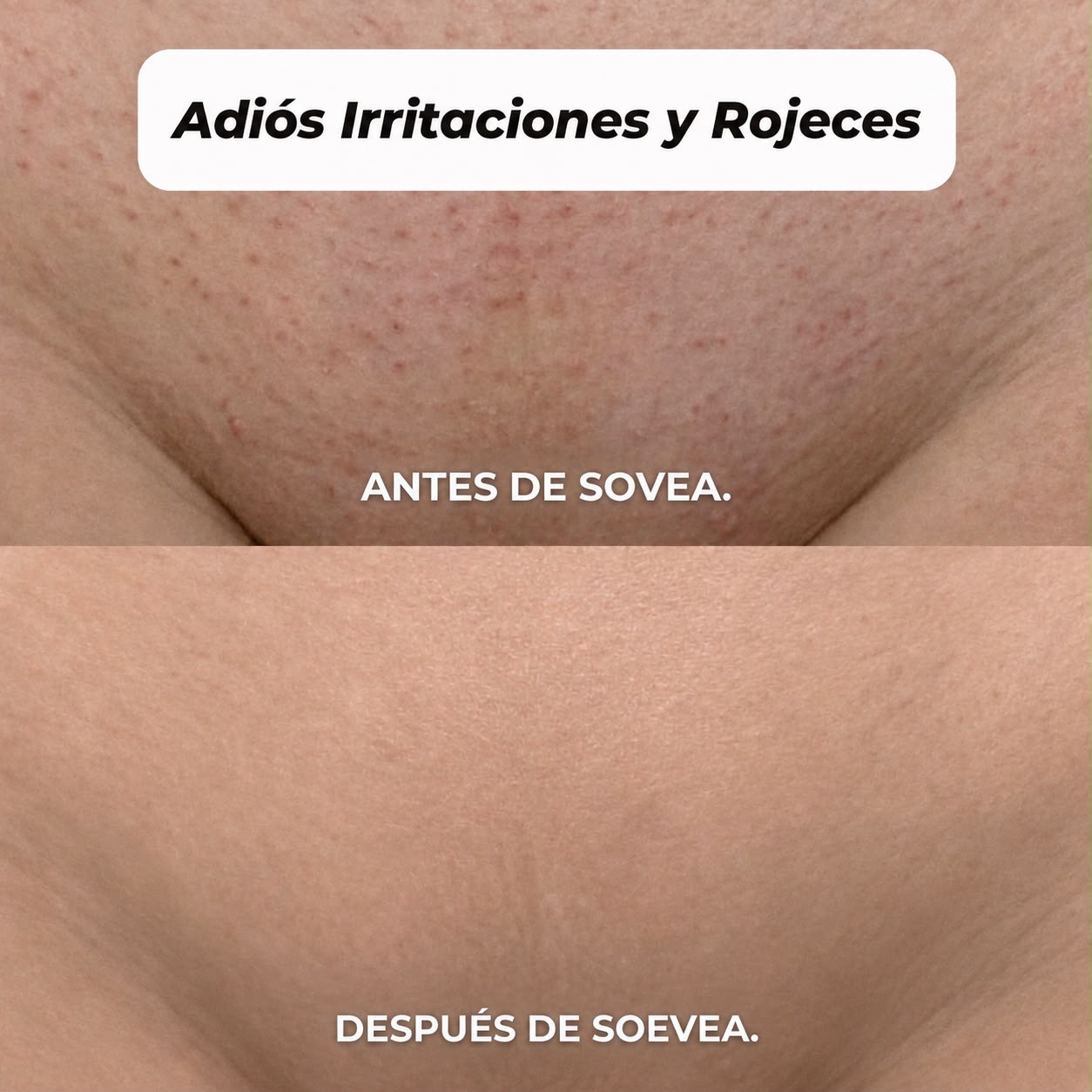 DEPILADORA 2 EN 1 PARA BIKINI Y CUERPO SOVEA™