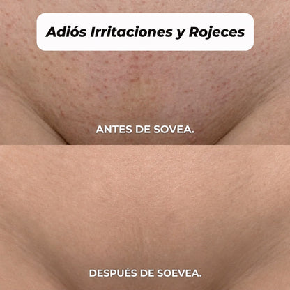 DEPILADORA 2 EN 1 PARA BIKINI Y CUERPO SOVEA™