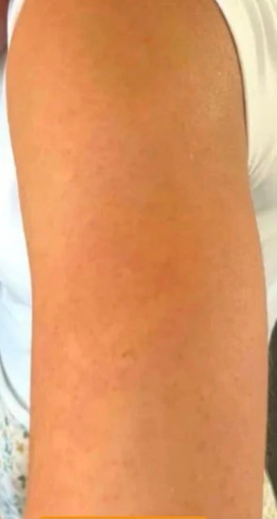 Dopo
