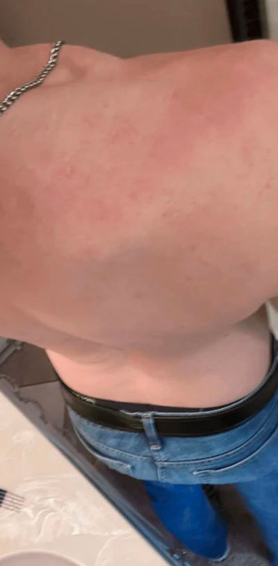 Dopo