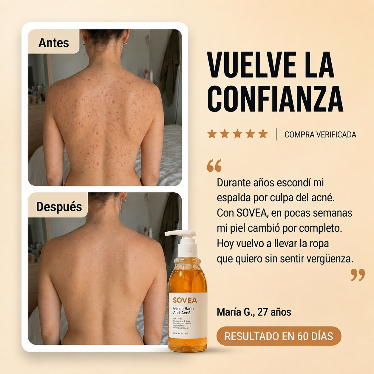 Gel De Baño Anti Acné SOVEA™