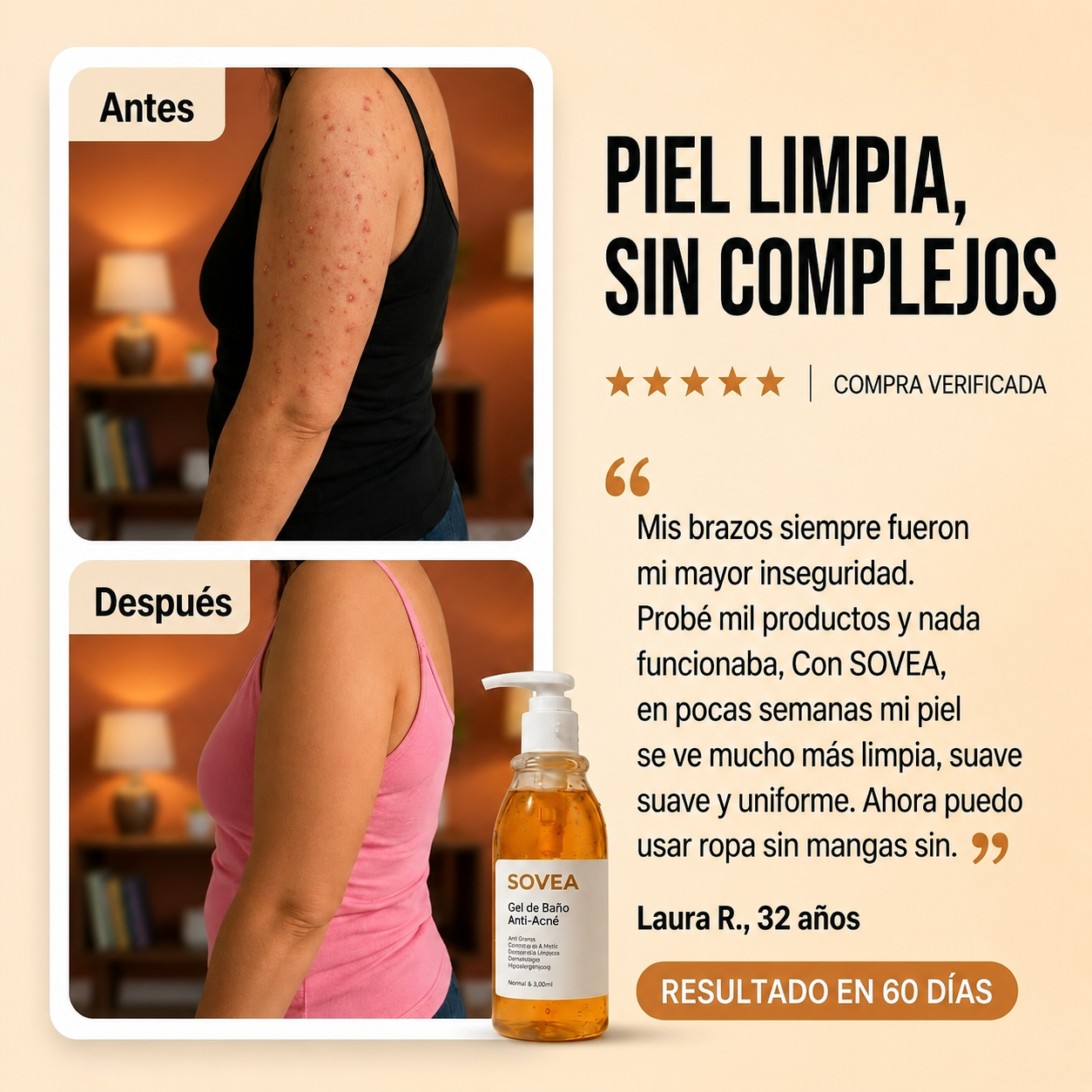 Gel De Baño Anti Acné SOVEA™